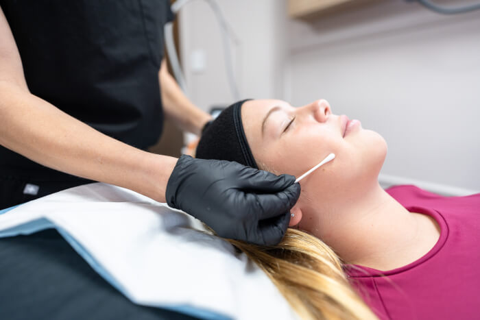 Medical Grade Peels