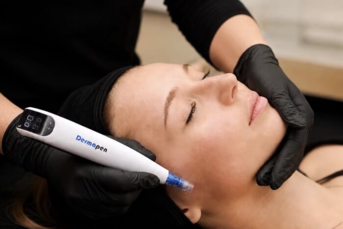 Medical Microneedling